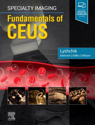 Cover of Specialty Imaging: Fundamentals of Ceus