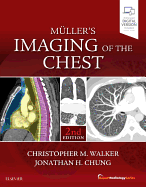 Cover of Muller's Imaging of the Chest: Expert Radiology Series
