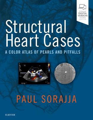 Cover of Structural Heart Cases: A Color Atlas of Pearls and Pitfalls