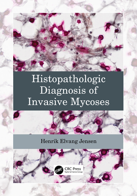 Cover of Histopathologic Diagnosis of Invasive Mycoses