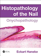 Cover of Histopathology of the Nail: Onychopathology