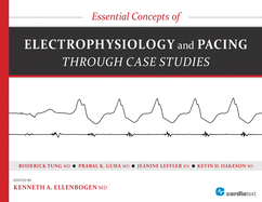 Cover of Essential Concepts of Electrophysiology and Pacing Through Case Studies