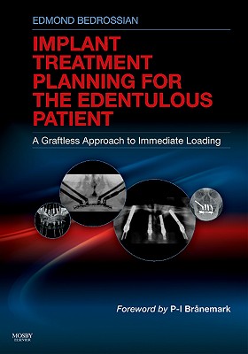 Cover of Implant Treatment Planning for the Edentulous Patient: A Graftless Approach to Immediate Loading