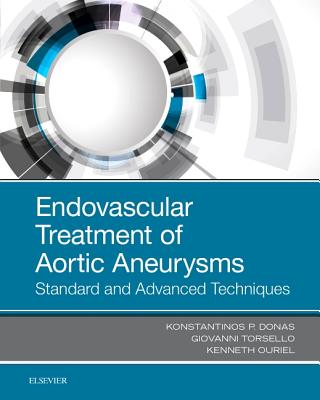 Cover of Endovascular Treatment of Aortic Aneurysms: Standard and Advanced Techniques