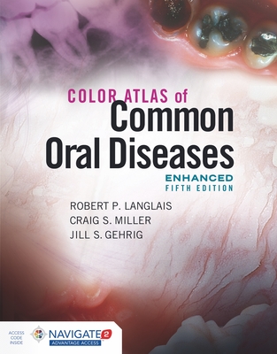 Cover of Color Atlas of Common Oral Diseases, Enhanced Edition
