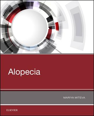 Cover of Alopecia