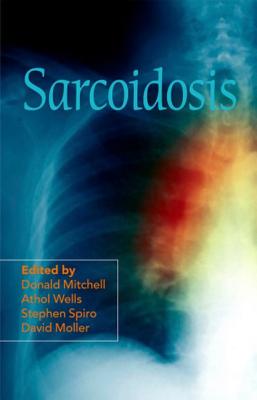 Cover of Sarcoidosis