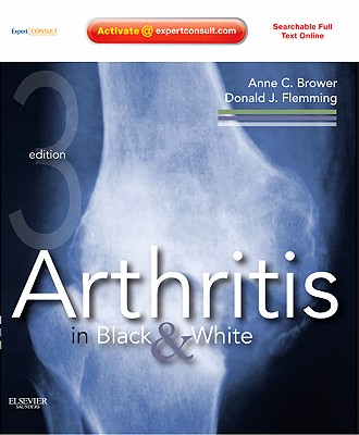 Cover of Arthritis in Black & White