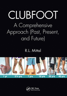 Cover of Clubfoot: A Comprehensive Approach (Past, Present, and Future)