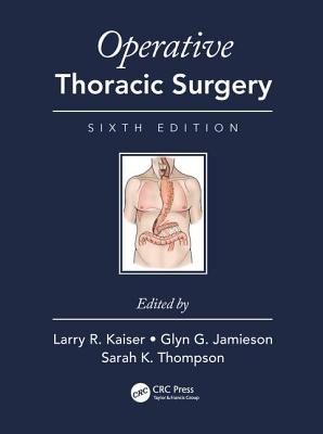 Cover of Operative Thoracic Surgery