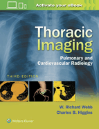 Cover of Thoracic Imaging: Pulmonary and Cardiovascular Radiology